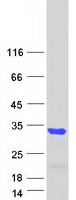 BCL11A Protein - Purified recombinant protein BCL11A was analyzed by SDS-PAGE gel and Coomassie Blue Staining