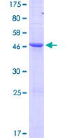 BCL2 / Bcl-2 Protein - 12.5% SDS-PAGE of human BCL2 stained with Coomassie Blue