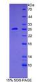 BCL2 / Bcl-2 Protein - Recombinant B-Cell Leukemia/Lymphoma 2 By SDS-PAGE