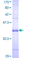 BCL2A1 Protein - 12.5% SDS-PAGE Stained with Coomassie Blue.