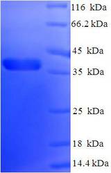 BCL2L1 / BCL-XL Protein