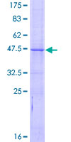 BCL2L10 / Diva Protein - 12.5% SDS-PAGE of human BCL2L10 stained with Coomassie Blue
