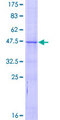 BCL2L10 / Diva Protein - 12.5% SDS-PAGE of human BCL2L10 stained with Coomassie Blue
