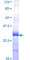 BCL2L10 / Diva Protein - 12.5% SDS-PAGE Stained with Coomassie Blue.