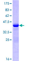 BCL2L11 / BIM Protein - 12.5% SDS-PAGE of human BCL2L11 stained with Coomassie Blue