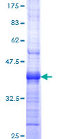 BCL2L11 / BIM Protein - 12.5% SDS-PAGE Stained with Coomassie Blue.
