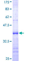 BCL2L12 Protein - 12.5% SDS-PAGE Stained with Coomassie Blue.