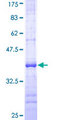BCL2L12 Protein - 12.5% SDS-PAGE Stained with Coomassie Blue.