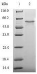 BCL2L14 / BCL-G Protein - (Tris-Glycine gel) Discontinuous SDS-PAGE (reduced) with 5% enrichment gel and 15% separation gel.