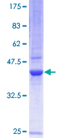 BCL2L2 / Bcl-w Protein - 12.5% SDS-PAGE of human BCL2L2 stained with Coomassie Blue
