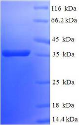 BCL2L2 / Bcl-w Protein