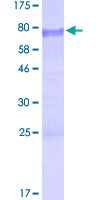 BCL3 / BCL-3 Protein - 12.5% SDS-PAGE of human BCL3 stained with Coomassie Blue