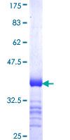 BCL6B Protein - 12.5% SDS-PAGE Stained with Coomassie Blue.