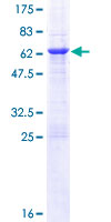 BCL7A Protein - 12.5% SDS-PAGE of human BCL7A stained with Coomassie Blue