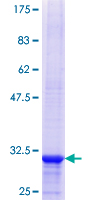 BCL7A Protein - 12.5% SDS-PAGE Stained with Coomassie Blue.