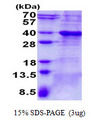 BCL7A Protein