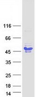 BCL7A Protein - Purified recombinant protein BCL7A was analyzed by SDS-PAGE gel and Coomassie Blue Staining