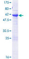 BCL7B Protein - 12.5% SDS-PAGE of human BCL7B stained with Coomassie Blue