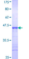 BCL7B Protein - 12.5% SDS-PAGE Stained with Coomassie Blue.