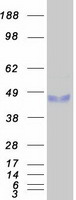 BCL7B Protein - Purified recombinant protein BCL7B was analyzed by SDS-PAGE gel and Coomassie Blue Staining