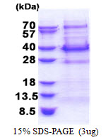 BCL7C Protein