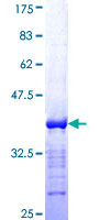 BCL9 Protein - 12.5% SDS-PAGE Stained with Coomassie Blue.