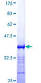 BCL9 Protein - 12.5% SDS-PAGE Stained with Coomassie Blue.