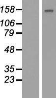 BCL9L Protein - Western validation with an anti-DDK antibody * L: Control HEK293 lysate R: Over-expression lysate