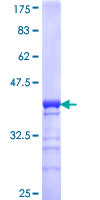 BCL9L Protein - 12.5% SDS-PAGE Stained with Coomassie Blue.