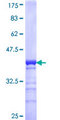 BCL9L Protein - 12.5% SDS-PAGE Stained with Coomassie Blue.