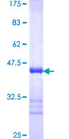 BCMP84 / S100A14 Protein - 12.5% SDS-PAGE Stained with Coomassie Blue.