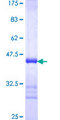 BCMP84 / S100A14 Protein - 12.5% SDS-PAGE Stained with Coomassie Blue.