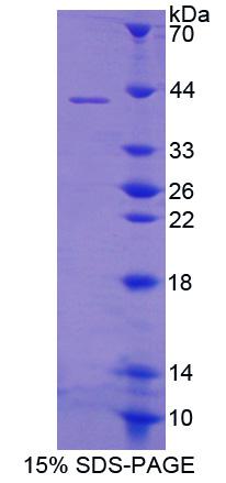 BCMP84 / S100A14 Protein - Recombinant S100 Calcium Binding Protein A14 By SDS-PAGE