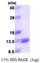 BCMP84 / S100A14 Protein