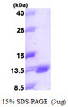 BCMP84 / S100A14 Protein