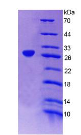 BCO1 / BCMO1 Protein - Recombinant  Beta-Carotene-15,15'-Monooxygenase 1 By SDS-PAGE