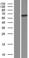 BCO2 / BCDO2 Protein - Western validation with an anti-DDK antibody * L: Control HEK293 lysate R: Over-expression lysate