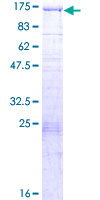 BCOR Protein - 12.5% SDS-PAGE of human BCOR stained with Coomassie Blue