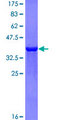 BCOR Protein - 12.5% SDS-PAGE Stained with Coomassie Blue.