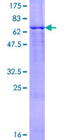 BCS1L Protein - 12.5% SDS-PAGE of human BCS1L stained with Coomassie Blue