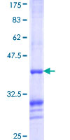 BCS1L Protein - 12.5% SDS-PAGE Stained with Coomassie Blue.