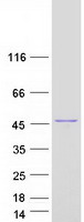 BCS1L Protein - Purified recombinant protein BCS1L was analyzed by SDS-PAGE gel and Coomassie Blue Staining