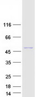 BCS1L Protein - Purified recombinant protein BCS1L was analyzed by SDS-PAGE gel and Coomassie Blue Staining