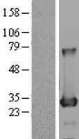 BDH2 Protein - Western validation with an anti-DDK antibody * L: Control HEK293 lysate R: Over-expression lysate
