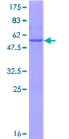 BDH2 Protein - 12.5% SDS-PAGE of human BDH2 stained with Coomassie Blue