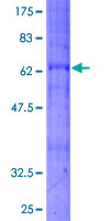 BDKRB2/Bradykinin B2 Receptor Protein - 12.5% SDS-PAGE of human BDKRB2 stained with Coomassie Blue
