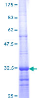 BDKRB2/Bradykinin B2 Receptor Protein - 12.5% SDS-PAGE Stained with Coomassie Blue.