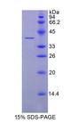 BDNF Protein - Recombinant Brain Derived Neurotrophic Factor By SDS-PAGE