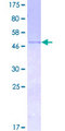 BDNF Protein - 12.5% SDS-PAGE of human BDNF stained with Coomassie Blue