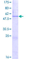 BDNF Protein - 12.5% SDS-PAGE of human BDNF stained with Coomassie Blue